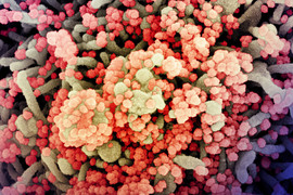 SARS-CoV-2 virus particles