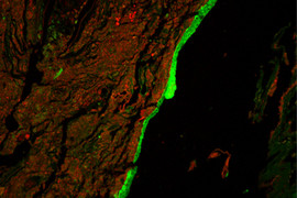 Mucus barrier, green, around red mass