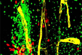 Immune cells in dura mater