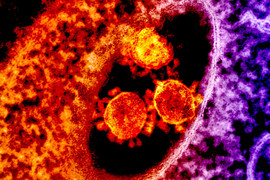 MERS coronavirus particles