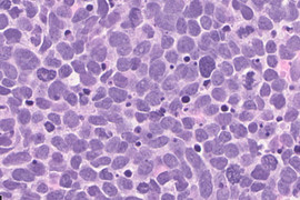 Small-cell lung carcinoma cells