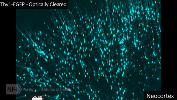 Neuroscience Fireworks