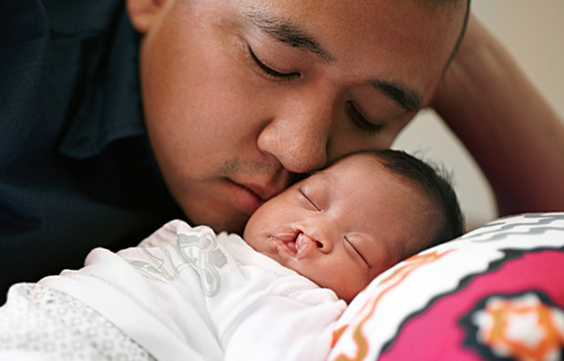 A sleeping baby with a cleft palate being cuddled by her father.