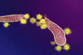 Transmission electron microscope image of SARS-CoV-2