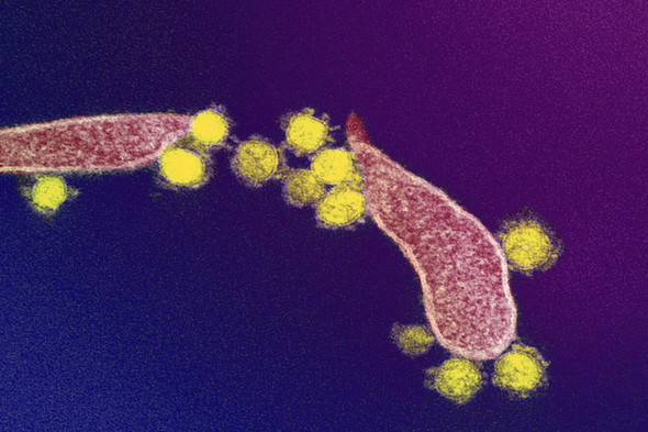 Transmission electron microscope image of SARS-CoV-2