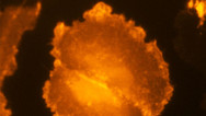 Melanoma Cell