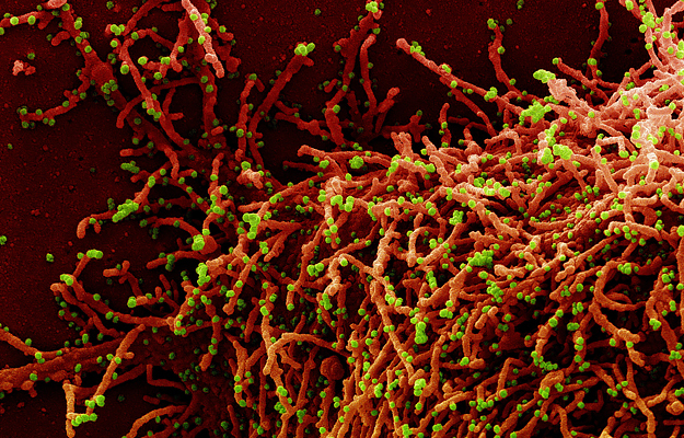 A colorized scanning electron micrograph of a cell infected with a variant strain of SARS-CoV-2 virus particles.