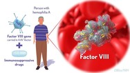 Gene Therapy for Hemophilia A