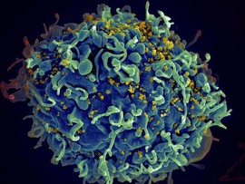 Human cell with HIV viruses on surface