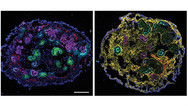 Kidney Organoids