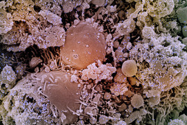 Cells infected with SARS-CoV-2