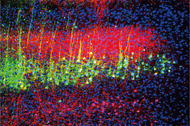 Neurons in a mouse brains auditory cortex