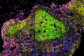 Fluorescent microscope image with dense area of green cells