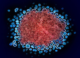 Numerous HIV particles surrounding a cell, with some emerging from it