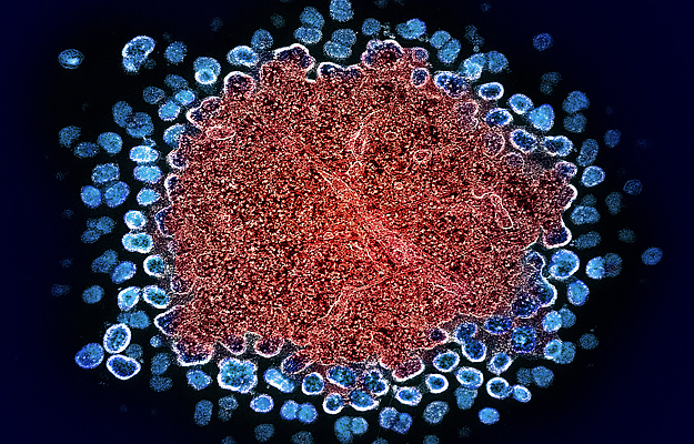 Numerous HIV particles surrounding a cell, with some emerging from it.