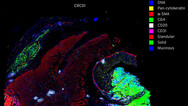 Colorectal Cancer Atlas