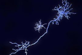 Microglial cell near the long stalk of a neuron