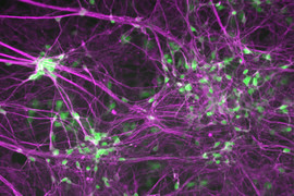 Human induced motor neurons