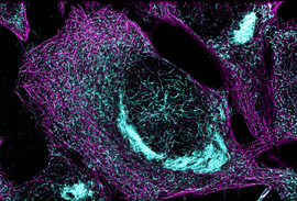 Microscope image of a cell with blue clumping throughout.