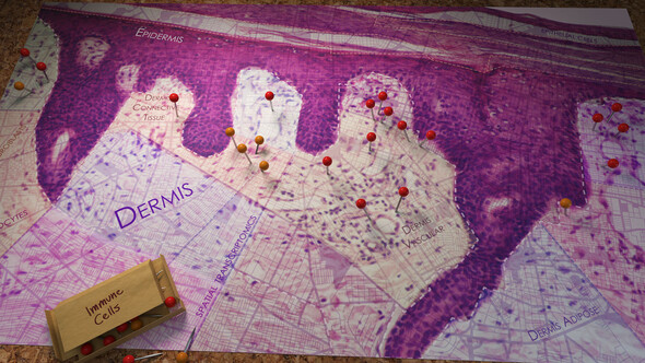 A light microscopy view of skin tissue shown as a map. A box of push pins are labeled Immune Cells. Pins are attached to areas in the dermis.