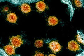 Circular SARS-CoV-2 particles with spikes.