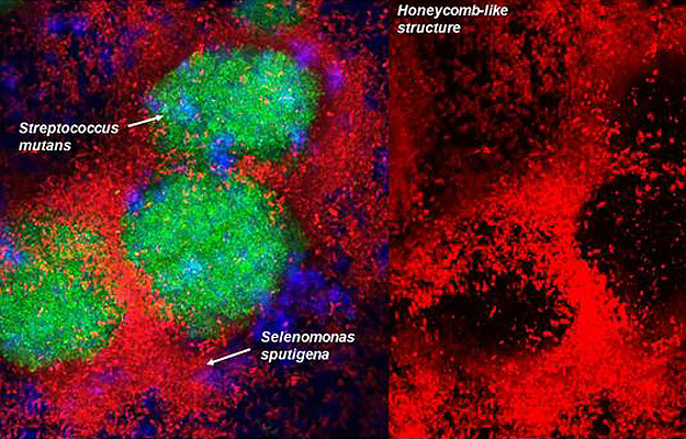 Selenomonas sputigena cells forming a honeycomb-like structure that encapsulates Streptococcus mutans.
