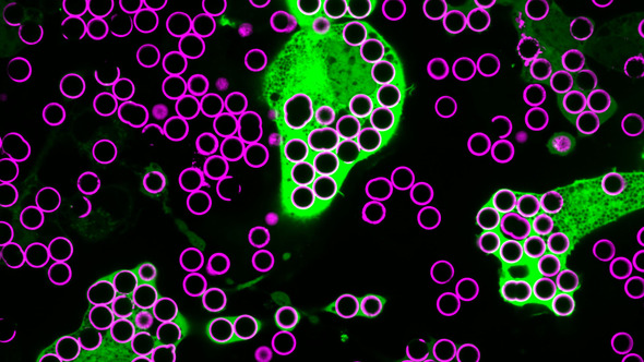 several macrophages (green blobs) consuming silica beads (purple circles) prepared with biochemicals 