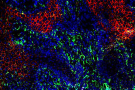 Immunofluorescence image with an area of disordered cells.