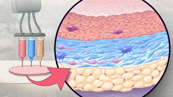 Artificial skin is printed with three syringes to print a hypodermis, dermis, and an epidermis layer.