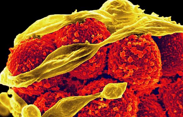 An illustration of methicillin-resistant Staphylococcus aureus bacteria.