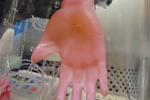 Bioengineered glove of human skin created for grafting.