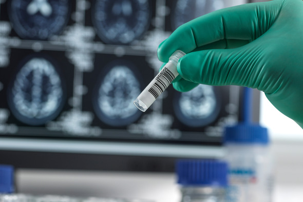 Gloved hand holding a test tube with brain images in background.