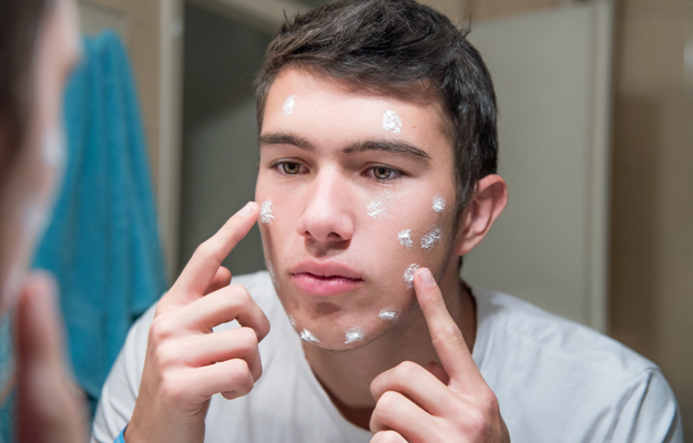 A young man applying topical cream to his face.