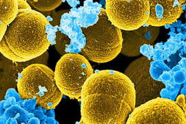 Spheroid shaped Staphylococcus aureus bacteria surrounded by white blood cells.