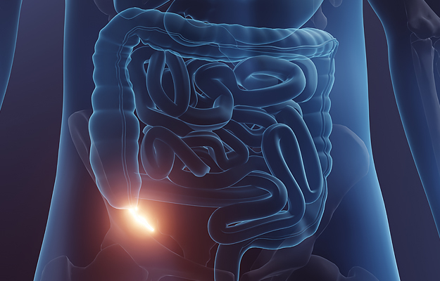 An illustration highlighting a human appendix.