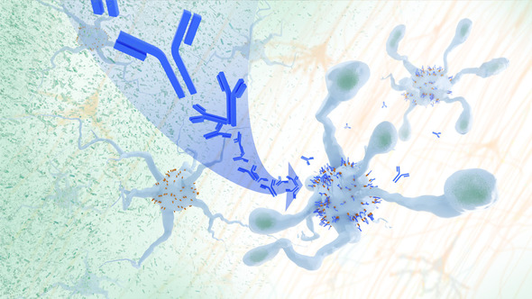 microglia in alzheimer's disease