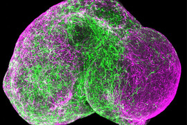 Image of a spherical organoid.