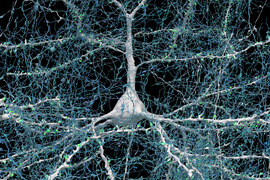 A large white nerve cell with long projections that are covered with green spots (synapses) and fine webbing of blue fibers, representing axons.