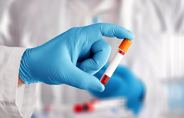 A close-up of a health care provider's hand holding a vial with a blood sample.