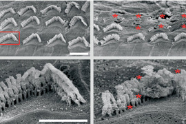 Scanning electron micrograph images of mouse inner ear hair cells.