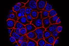 Pancreatic cancer cells