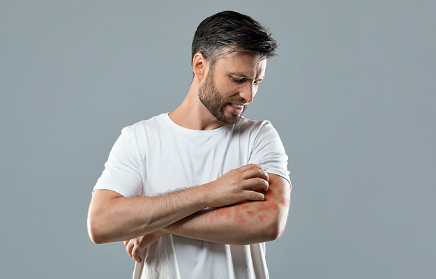 A man scratching a rash on his arm.