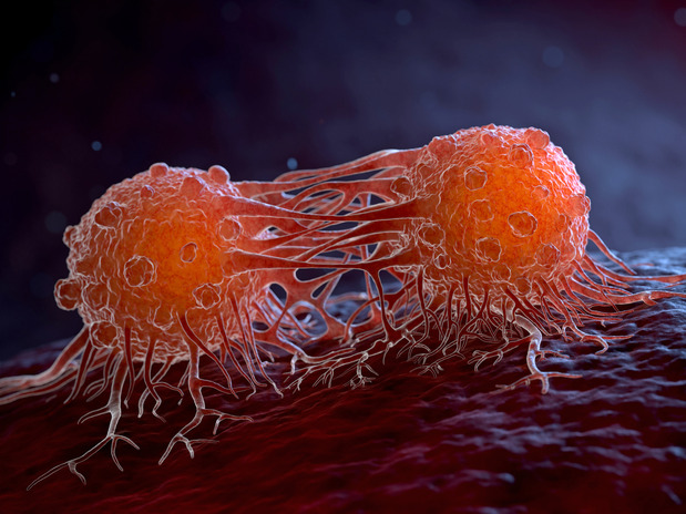 An illustration of a dividing cancer cell.