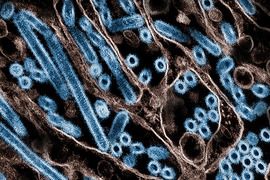 Electron micrograph shows long rods and circular cross-sections of virus particles.