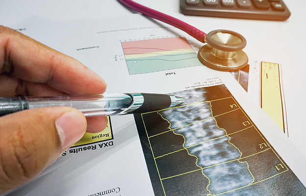 A close-up of a doctor's hand pointing a pen at dual energy x-ray absorptiometry (DXA) results.