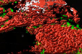 Screenshot of video describing how the complexity of tumors has been revealed in 3D.