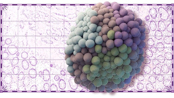 Simulated tumor over cancer map