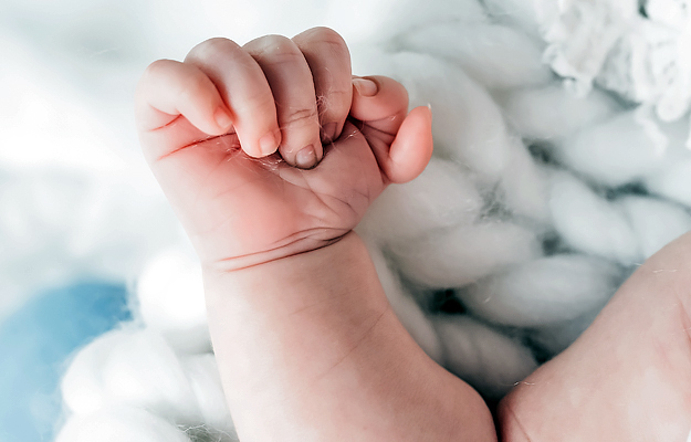 A close-up of a baby's hand with polydactyly.