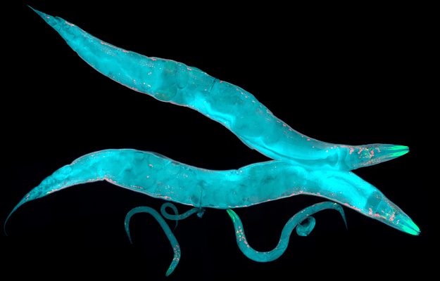 An illustration of Caenorhabditis elegans (C. elegans) under a microscope.