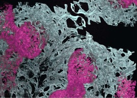 Microscope image showing clusters of air sacs surrounded by blood vessels.